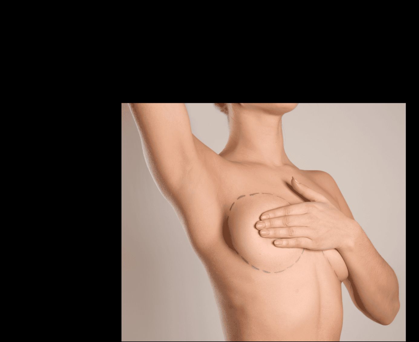 Four Essential Tips for a Healthy Breast Augmentation Recovery